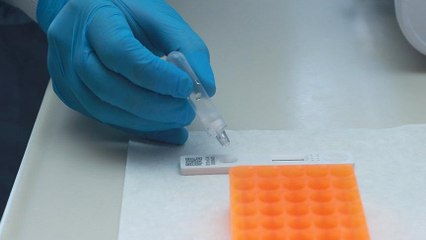 Corona virüsü testi sonucu 15 dakikada çıkacak