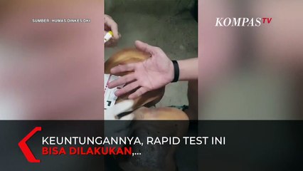 Kelebihan dan Kelemahan Rapid Test Dengan Sampel Darah