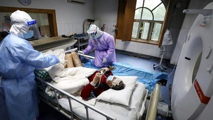 İyileşen korona hastasının akciğerinde sıvı veya parçacık dolu keseler bulundu