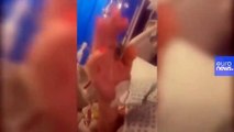 39 yaşındaki kadın corona virüs yoğun bakımından bir video paylaştı ve uyarıyor: 
