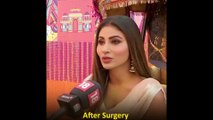 10 TV Actresses Before and After Plastic Surgery