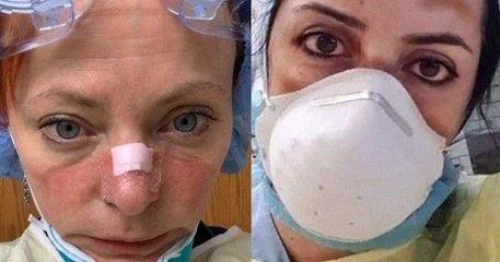 Coronavirus : les visages meurtris du personnel soignant à travers le monde