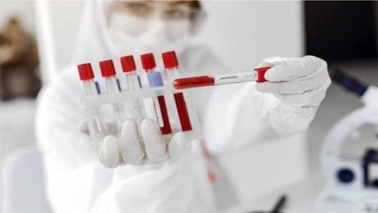 VIDEO: How private labs test coronavirus cases?