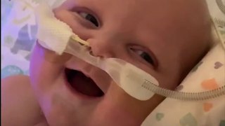 Baby was captured smiling for the first time after his second open-heart surgery