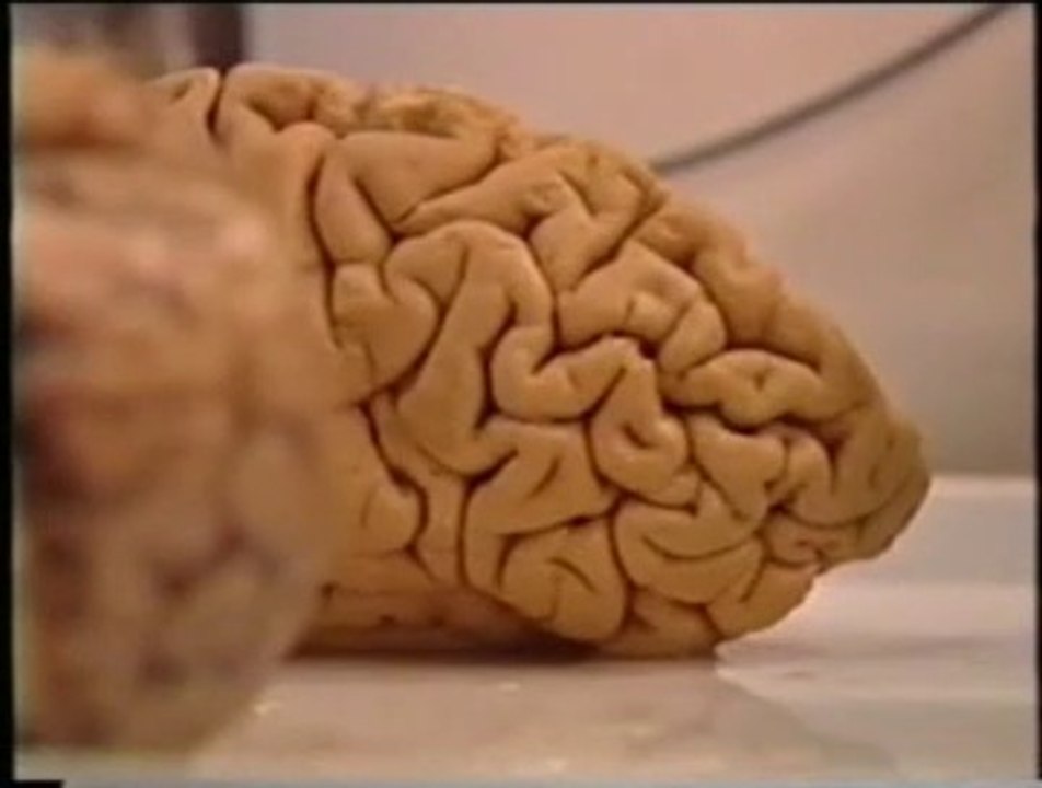 Cerebro: Memoria emocional