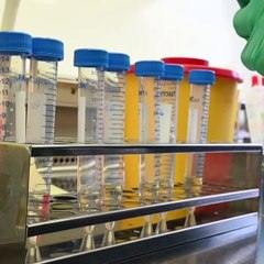 Brasil tem 2433 casos confirmados e 57 mortes