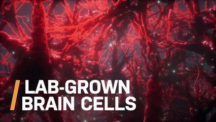 Scientists Grow Brain Cells From Skin Cells In a Dish