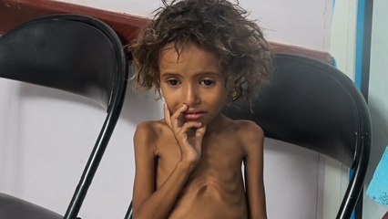 مطالب أممية بوقف الحرب اليمنية ومخاوف من تعميق كورونا للأزمة الإنسانية