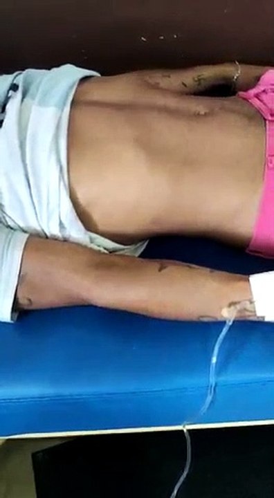 देखिए कोरोना पीड़ित की साँसे कईसे चल रही हैं