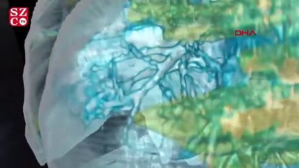 Koronavirüs bulunan akciğerin 3D görüntüsü yayınlandı