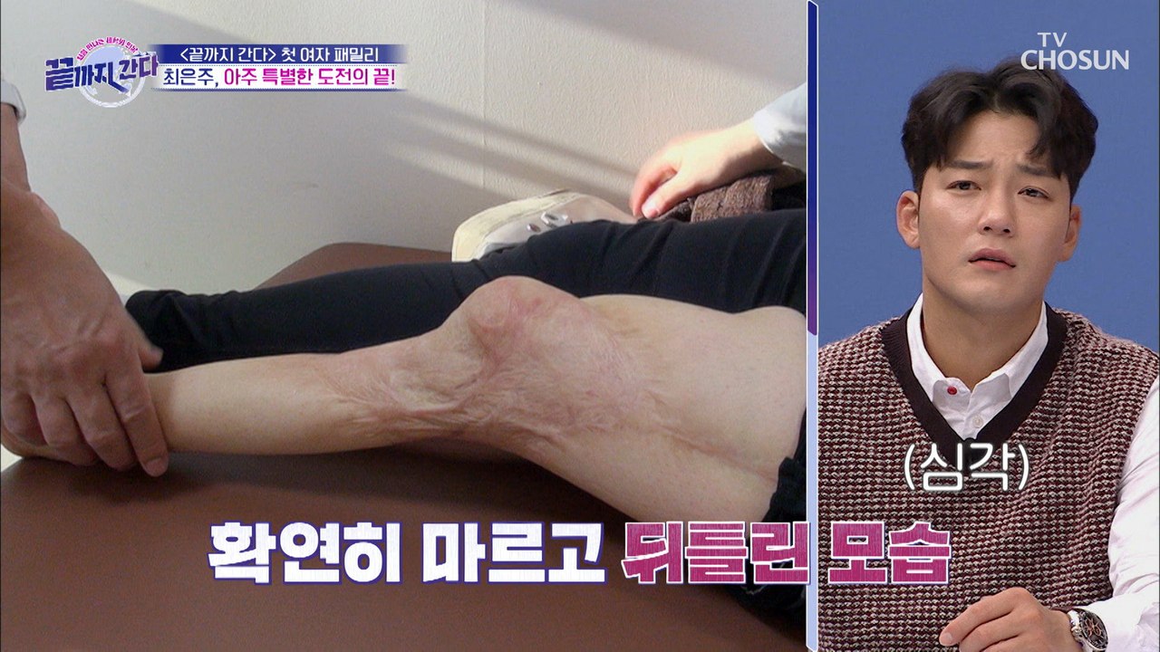 (안타까움) 예고 없이 찾아온 사고.. 다리 절단?!