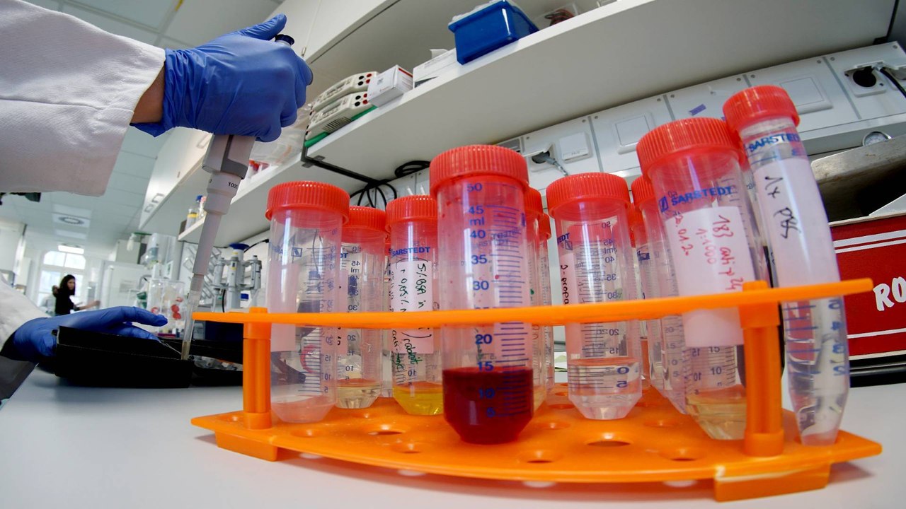 Covid 19: Are people with this blood group at h...
