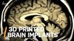 These Are the 3D Printed Brain Implants of the Future
