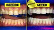 Worst-Rated Orthodontist on Yelp Whitened My Teeth