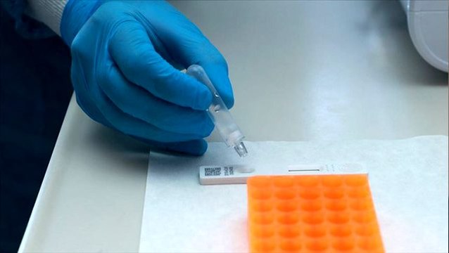 44 ilimizde 73 merkez, koronavirüs tanı laboratuvarı olarak yetkilendirildi