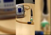 Médico português descobriu alteração nos ventiladores que pode salvar milhares de vidas