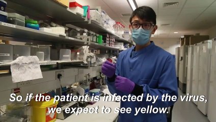 Coronavirus: new 30-minute Oxford University test nears validation