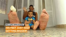 He's got the biggest feet in the world & they're still growing!