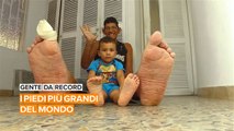 Gente da record: il ragazzo con i piedi più grandi del mondo