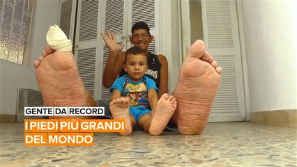 Gente da record: il ragazzo con i piedi più grandi del mondo