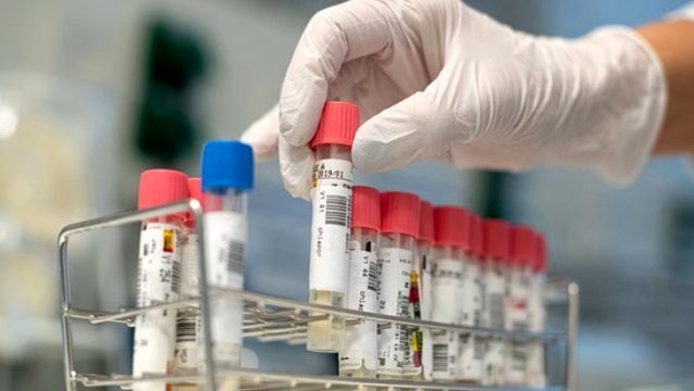 Son Dakika: Dünya genelindeki koronavirüs vaka sayısı 1 milyonu aştı