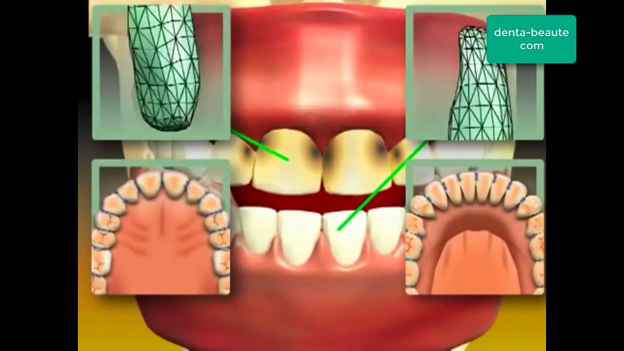 Infos für gesunde und schöne Zähne