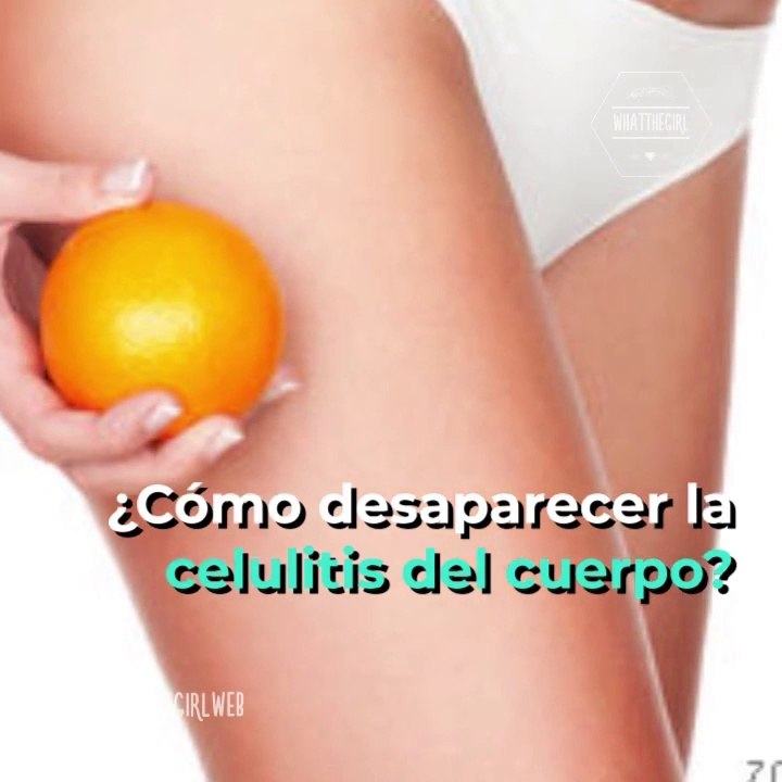 CELULITIS: MÉTODO EFICAZ PARA DECIRLE ADIÓS | C...