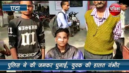 चेकिंग के दौरान पैसे न देने पर पुलिस ने किशोर को बेरहमी से पीटा