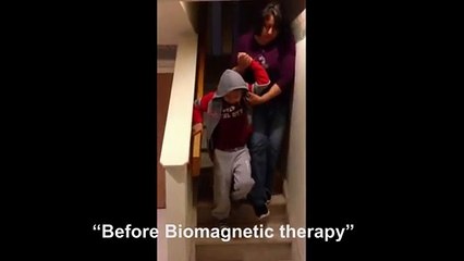 Patient instantly heals [Biomagnetism Therapy]