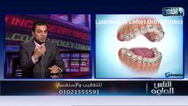 الناس الحلوة | فنيات تقويم الاسنان مع دكتور محمد عاطف