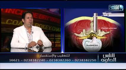 الناس الحلوة | الجديد في علاج المخ والاعصاب مع دكتور يسري الحميلي