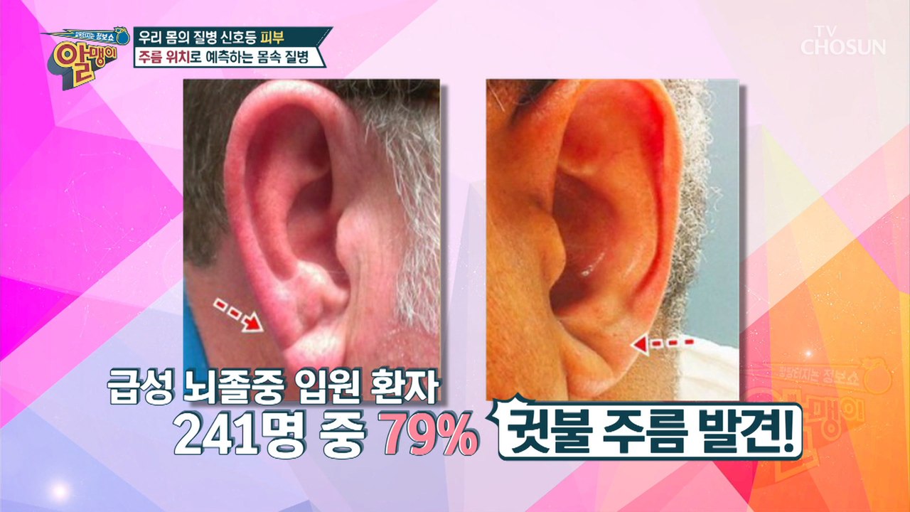 ≈주름≈ 위치로 예측하는 여러 가지 질병 신호!