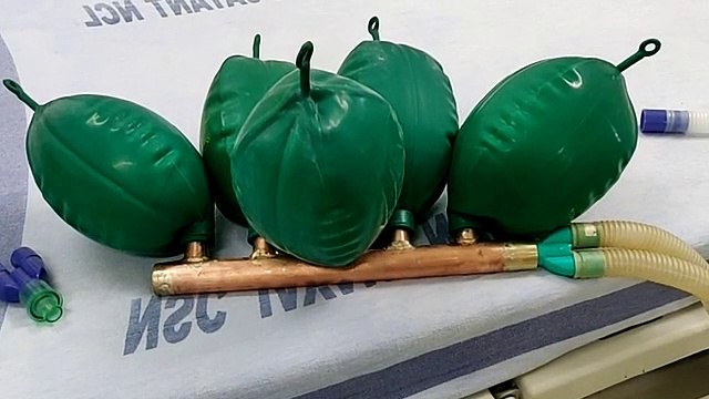 One Ventilators Can Save Lives Of Five COVID-19 Patients