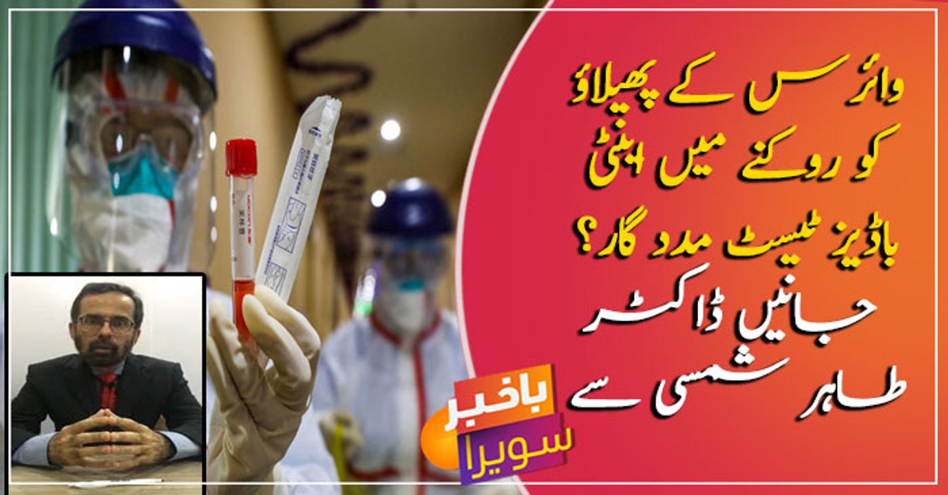Are antibodies test helpful to prevent coronavirus?
