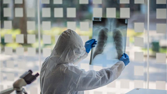 Trial Testing Arthritis Drug Against The Coronavirus Underway In US And Spain