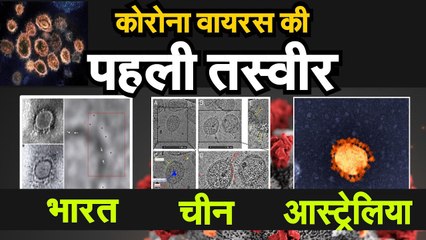 coronavirus first image from india कोरोना  की पहली तस्वीर देखिए कितना अलग है चीन और भारत का virus