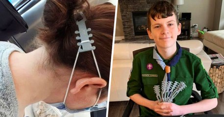 Ce scout canadien invente un objet pour soulager la douleur des infirmières portant des masques
