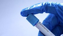 Sakarya Üniversitesi'nin koronavirüsle ilgili aşı geliştirme projesi kabul edildi