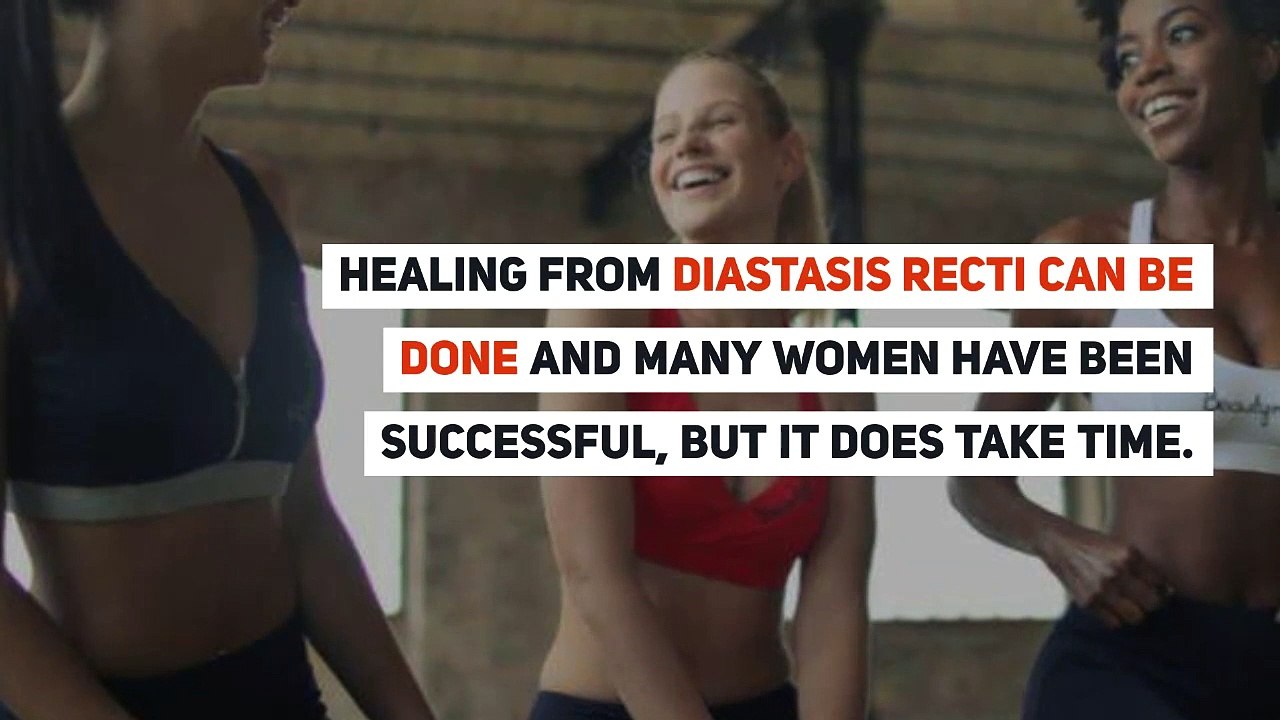 Can Diastasis Recti Be Fixed By Surgery