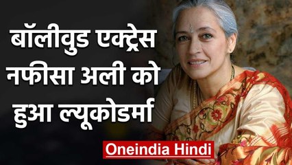 Nafisa Ali on Being Diagnosed with Leucoderma, shares emotional post on Instagram | वनइंडिया हिंदी