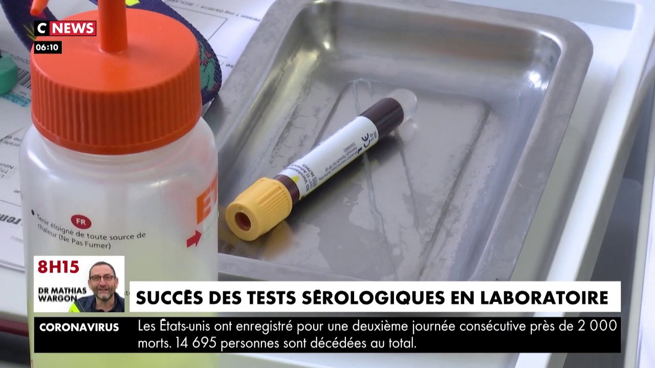 Coronavirus : un test sérologique en laboratoire proposé à Beauvais