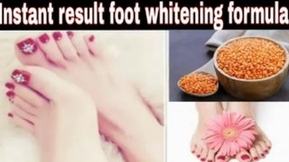 Feet whitening remedy | Paon gora karne ka tarika | Home remedy