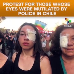 Protest For Those Whose Eyes Were Mutilated By Police In Chile