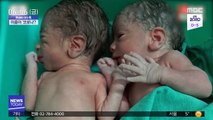 [이슈톡] 인도 쌍둥이 이름이 '코로나'와 '코비드'