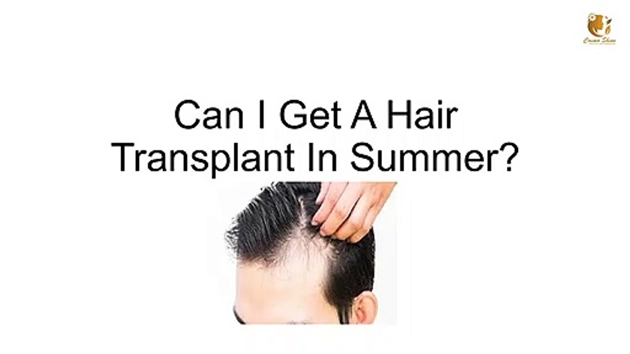 Can I Get A Hair Transplant In Summer?
