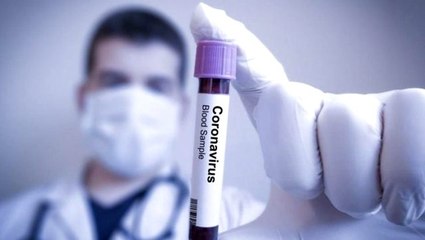 Fransız bilim insanları koronavirüsün 3 yeni belirtisini daha ortaya çıkardı