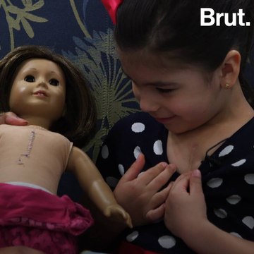 Dolls With Surgery Scars Help Heal Kids' Confidence