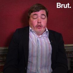 He attempted suicide due to relentless bullying