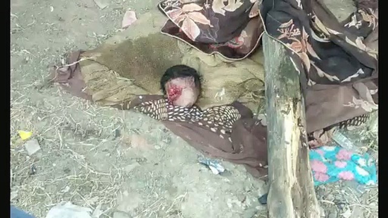झोपड़े में मिला नवजात बच्चे का सिर