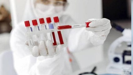 Nonstop 100: Amid lockdown covid-19 cases on rise